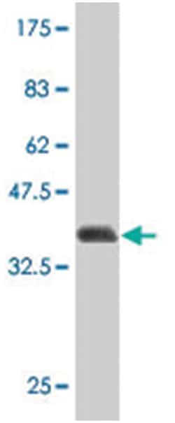 PLA1A, Mouse, Polyclonal Antibody, Abnova 50&mu;L; Unlabeled:Antibodies,