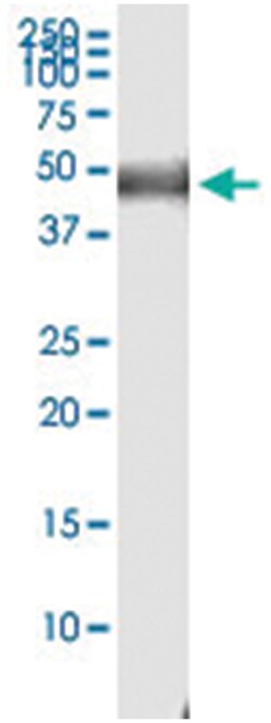 anti-PLA1A, Human, IP-WB Antibody Pair, Abnova™