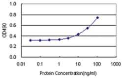 anti-TEX264 Matched Antibody Pair, Abnova™