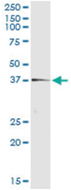 anti-TEX264, Human, IP-WB Antibody Pair, Abnova 1 Set:Antibodies, Monoclonal/Polyclonal