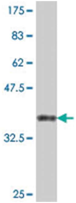 ATP6V1D, Mouse, Polyclonal Antibody, Abnova 50&mu;L; Unlabeled:Antibodies,