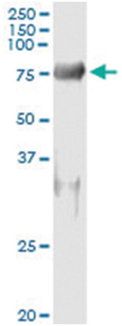 SNX9, Human, IP-WB Antibody Pair (PW2), Abnova&trade;
