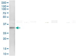 anti-HSD17B7, Human, IP-WB Antibody Pair, Abnova&trade;