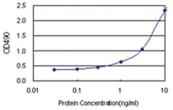 NOP16, Human, Matched Antibody Pair (AP23), Abnova&trade;