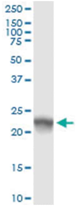 anti-NOP16, Human, IP-WB Antibody Pair, Abnova 1 Set:Antibodies, Monoclonal/Polyclonal