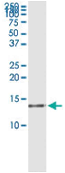 anti-HSPC152, Human, IP-WB Antibody Pair, Abnova 1 Set:Anticuerpos