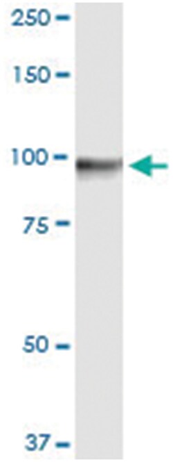 anti-GTSE1, Human, IP-WB Antibody Pair, Abnova™