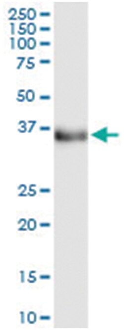 anti-ETV7, Human, IP-WB Antibody Pair, Abnova&trade;