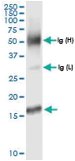 anti-MTP18, Human, IP-WB Antibody Pair, Abnova 1 Set:Antibodies, Monoclonal/Polyclonal