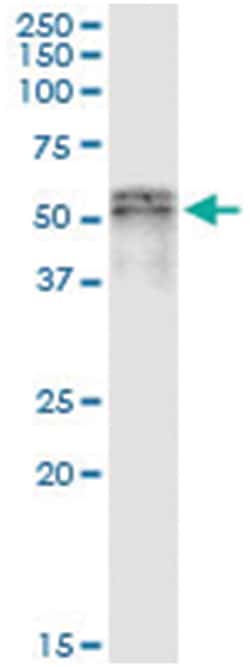 SCLY, Human, IP-WB Antibody Pair (PW2), Abnova 1 Set:Antibodies, Monoclonal/Polyclonal