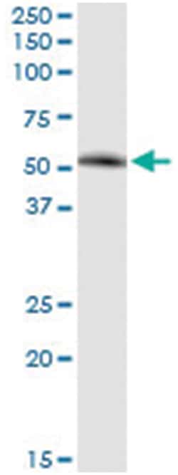 anti-SIRT7, Human, IP-WB Antibody Pair, Abnova&trade;