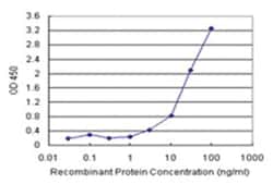 anti-HDAC7 Matched Antibody Pair, Ab-1, Abnova 1 Set:Antibodies, Monoclonal/Polyclonal