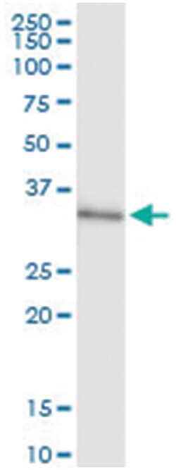 anti-HDAC7, Human, IP-WB Antibody Pair, Abnova™