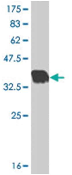 MIR16, Mouse, Polyclonal Antibody, Abnova 50&mu;L; Unlabeled:Antibodies,