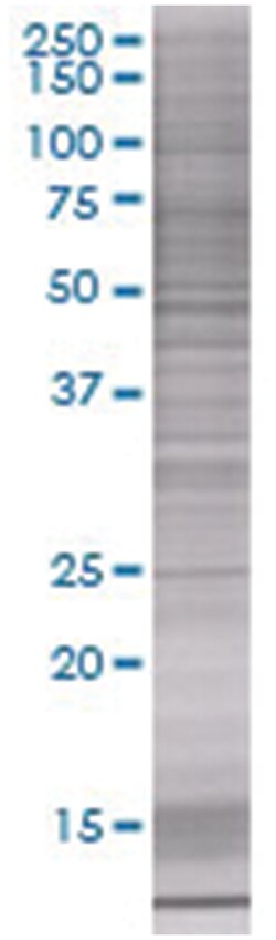 PFS2 293T Cell Overexpression Lysate (Denatured), Abnova 100 &mu;L | Buy Online | Abnova | Fisher Scientific