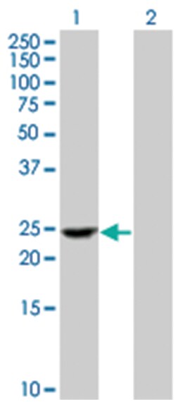 PFS2 293T Cell Overexpression Lysate (Denatured), Abnova 100 &mu;L | Buy Online | Abnova | Fisher Scientific