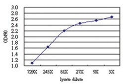 anti-ACSL5 Matched Antibody Pair, Abnova™