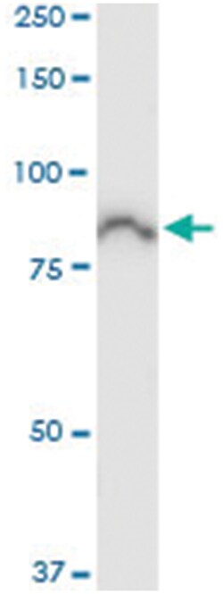 ACSL5, Human, IP-WB Antibody Pair (PW2), Abnova&trade;