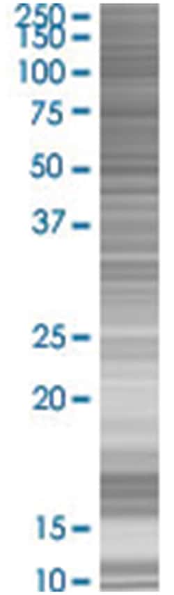 ZNF44 293T Cell Overexpression Lysate (Denatured), Abnova 100 &mu;L | Buy Online | Abnova | Fisher Scientific