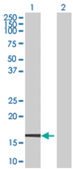 ZNF44 293T Cell Overexpression Lysate (Denatured), Abnova 100 &mu;L | Buy Online | Abnova | Fisher Scientific