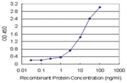 anti-RAB23 Matched Antibody Pair, Abnova