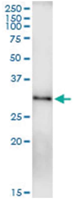 anti-RAB23, Human, IP-WB Antibody Pair, Abnova&trade;