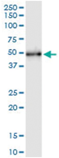 anti-UIMC1, Human, IP-WB Antibody Pair, Abnova&trade;
