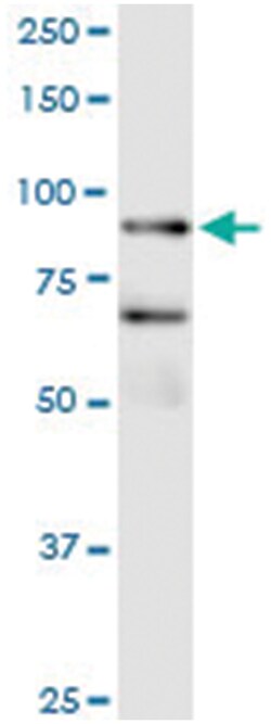 anti-FBXO40, Human, IP-WB Antibody Pair, Abnova 1 Set:Antibodies, Monoclonal/Polyclonal