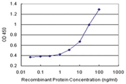anti-POLR3K Matched Antibody Pair, Abnova 1 Set:Antibodies, Monoclonal/Polyclonal