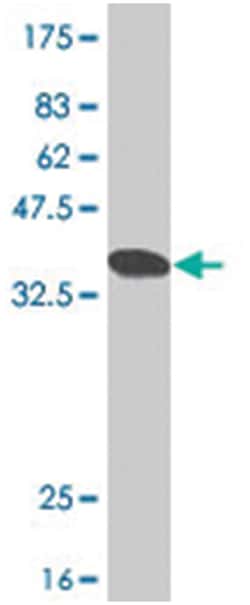 INPP5K, Mouse, Polyclonal Antibody, Abnova 50&mu;L; Unlabeled:Antibodies,