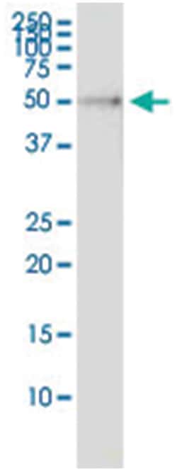 anti-RP6-213H19.1, Human, IP-WB Antibody Pair, Abnova 1 Set | Buy Online | Abnova Corporation | Fisher Scientific