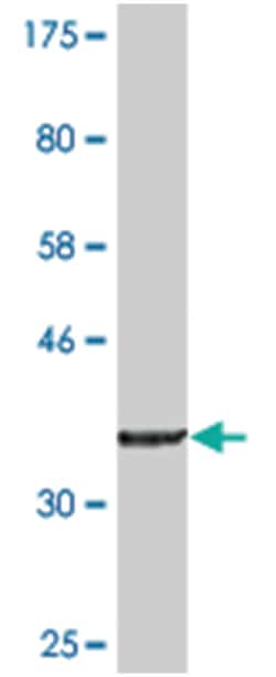 ZAK, Mouse, Clone: 4C4, Abnova 200&mu;L; Unlabeled:Anticuerpos