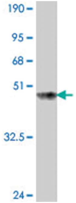 SIX4, Mouse, Polyclonal Antibody, Abnova 50&mu;L; Unlabeled:Antibodies,