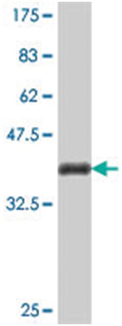 CALML5, Mouse, Polyclonal Antibody, Abnova 50&mu;L; Unlabeled:Antibodies,