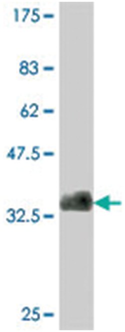 BCL11A, Mouse, Polyclonal Antibody, Abnova 50&mu;L; Unlabeled:Antibodies,