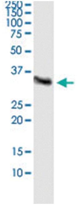 anti-BCL11A, Human, IP-WB Antibody Pair, Abnova 1 Set:Antibodies, Monoclonal/Polyclonal