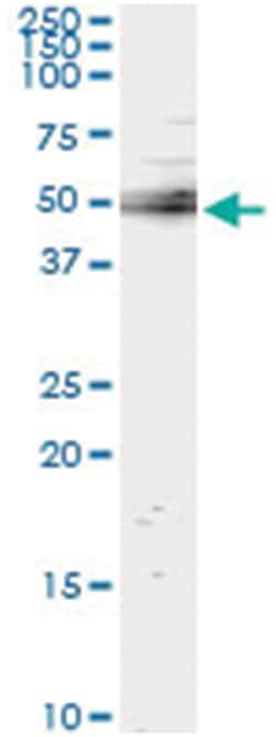 anti-UBASH3A, Human, IP-WB Antibody Pair, Abnova&trade;