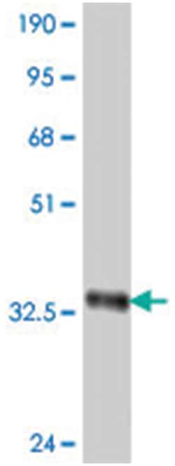 LRP1B, Mouse, Polyclonal Antibody, Abnova 50&mu;L; Unlabeled:Antibodies,