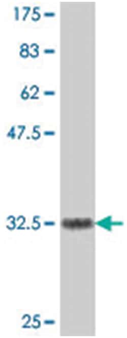 TRIM34, Mouse, Polyclonal Antibody, Abnova 50 &mu;L | Buy Online | Abnova Corporation | Fisher Scientific