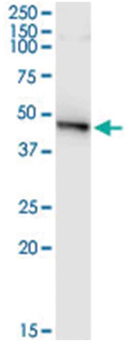 anti-PELO, Human, IP-WB Antibody Pair, Abnova&trade;