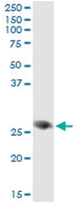 anti-FAM3B, Human, IP-WB Antibody Pair, Abnova&trade;