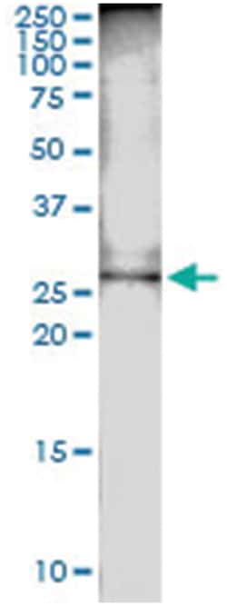 anti-DCUN1D1, Human, IP-WB Antibody Pair, Abnova&trade;