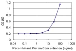 anti-TREM1 Matched Antibody Pair, Abnova