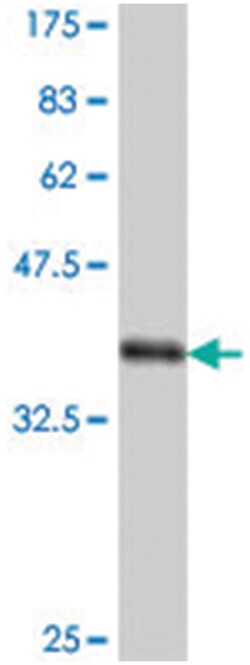 NLGN3, Mouse, Polyclonal Antibody, Abnova 50&mu;L; Unlabeled:Antibodies,