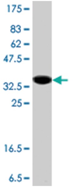 DNAJC10, Mouse, Polyclonal Antibody, Abnova 50&mu;L; Unlabeled:Antibodies,