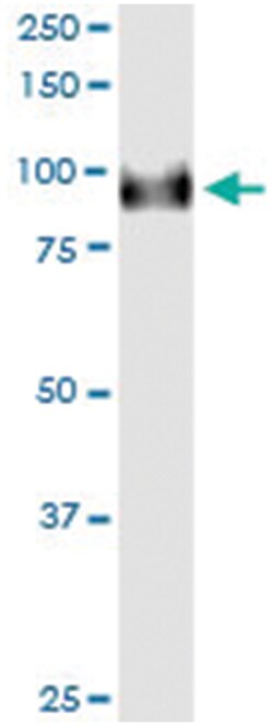 anti-FBXO42, Human, IP-WB Antibody Pair, Abnova™