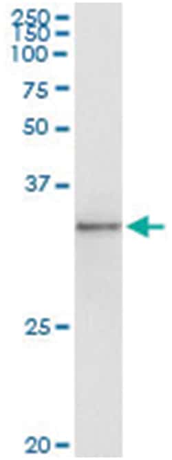 TOLLIP, Human, IP-WB Antibody Pair (PW2), Abnova&trade;