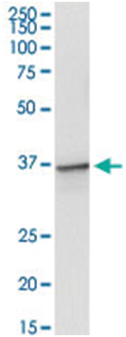 TOLLIP, Human, IP-WB Antibody Pair (PW3), Abnova 1 Set:Antibodies, Monoclonal/Polyclonal