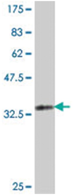EGLN1, Mouse, Polyclonal Antibody, Abnova 50 &mu;L | Buy Online | Abnova | Fisher Scientific