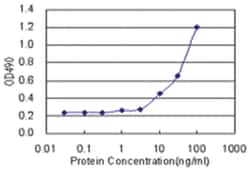 anti-LZTFL1 Matched Antibody Pair, Abnova&trade;